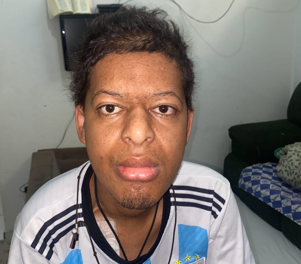 Jesus me tirou das mãos da morte”: jovem com duas doenças raras sobrevive a transplante e pede ajuda para seguir o tratamento